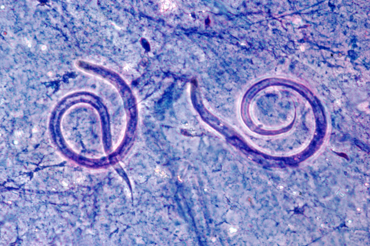 Research image of two roundworms.