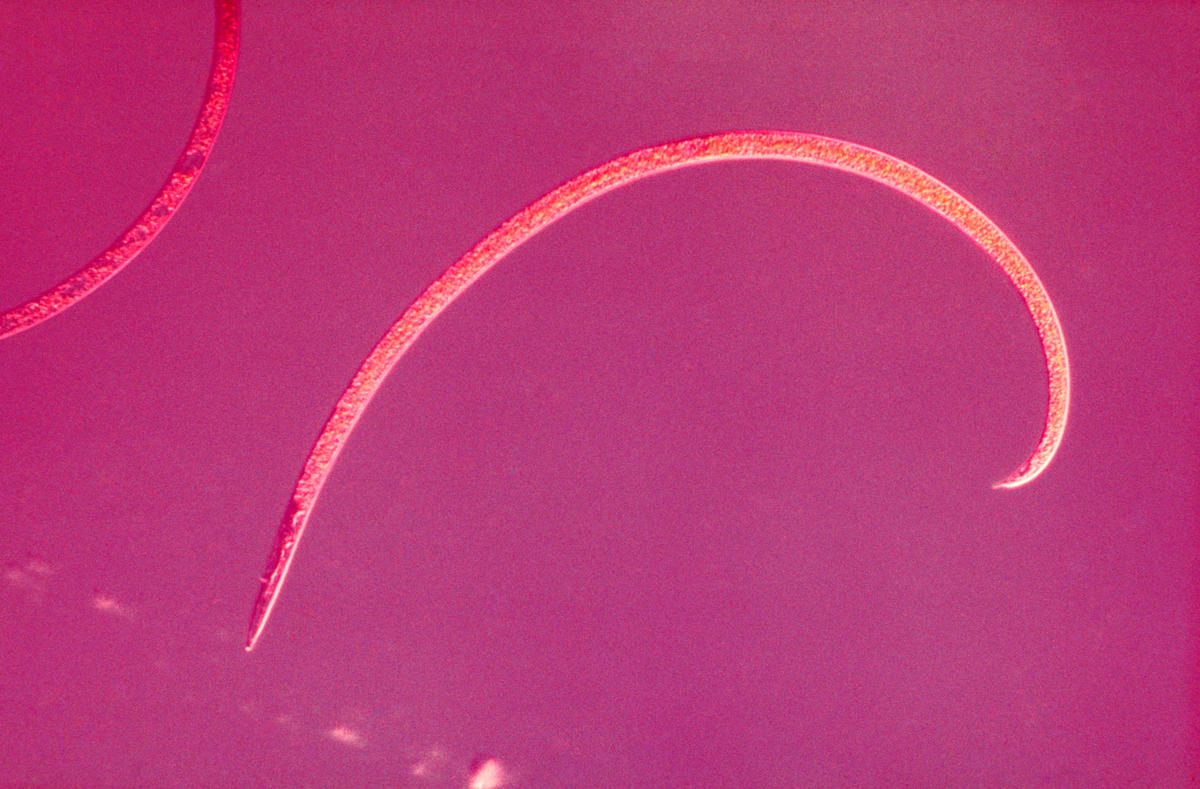 Image of roundworms.