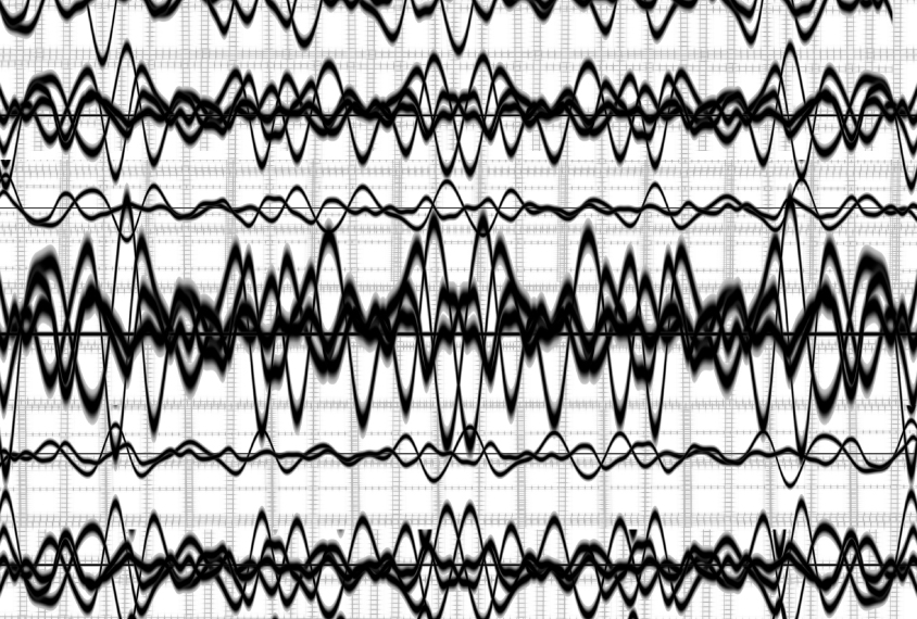Brain waves against a solid white background