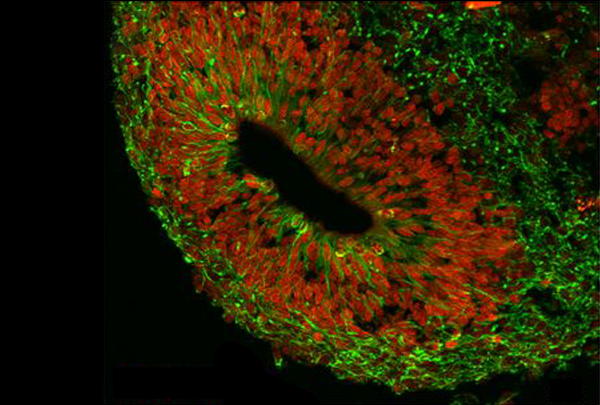 Image of stem cells that have differentiated into a variety of brain cell types.