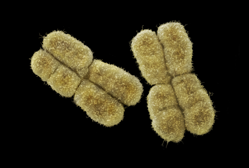 Scanning electron micrograph view of human chromosomes pair number three.