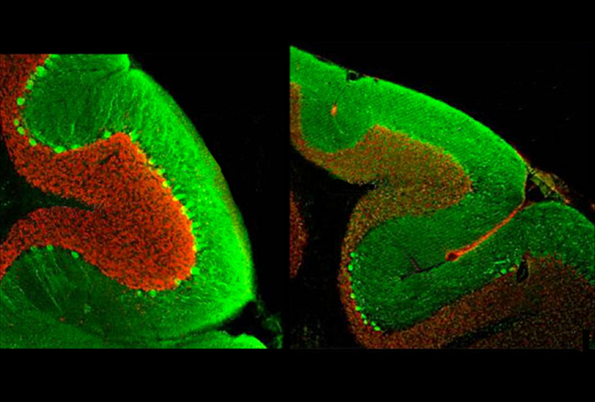 Research image of two mice cerebellums.