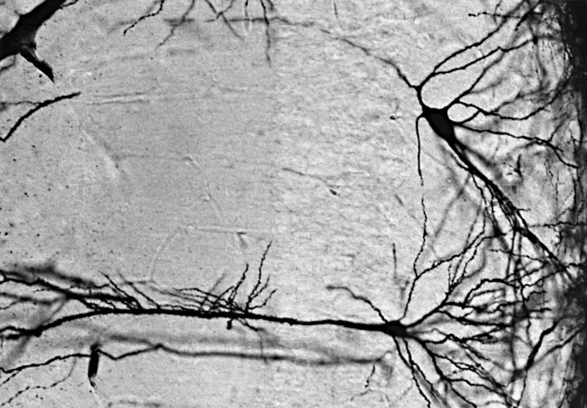 Micrograph of interneuron and pyramidal neuron in the hippocampus.