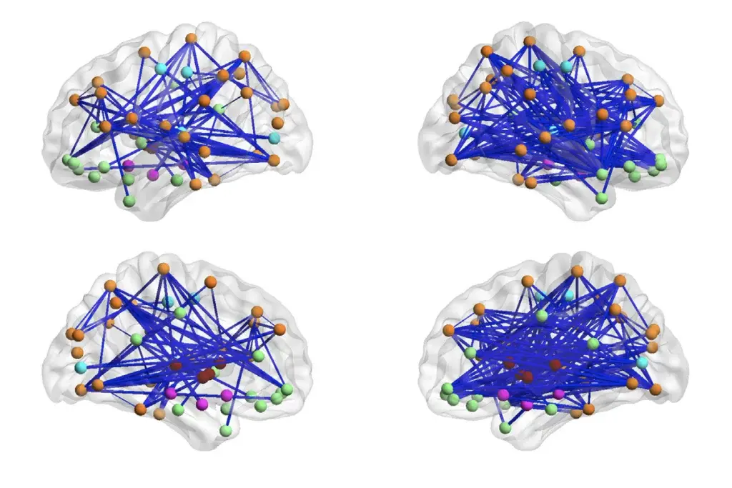 Image visualizing connections in the brain.