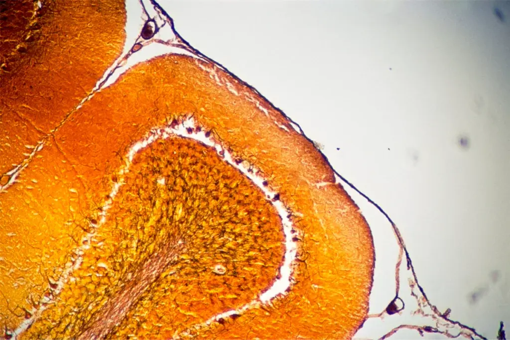 Photograph of a magnified section of a cerebellum showing nerve cells in a human brain.