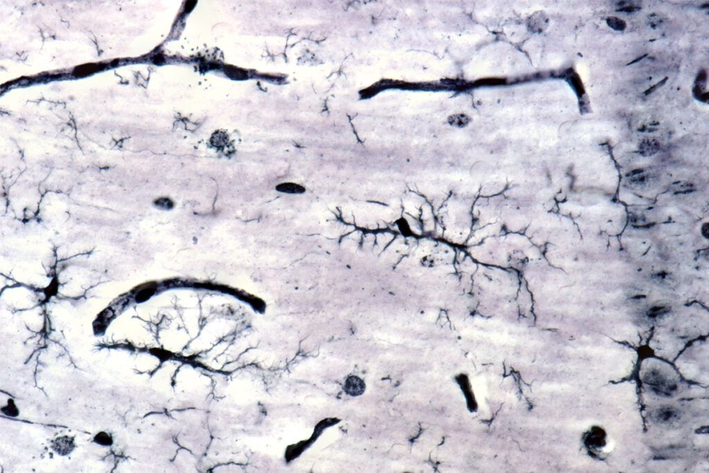 Image of microglia.