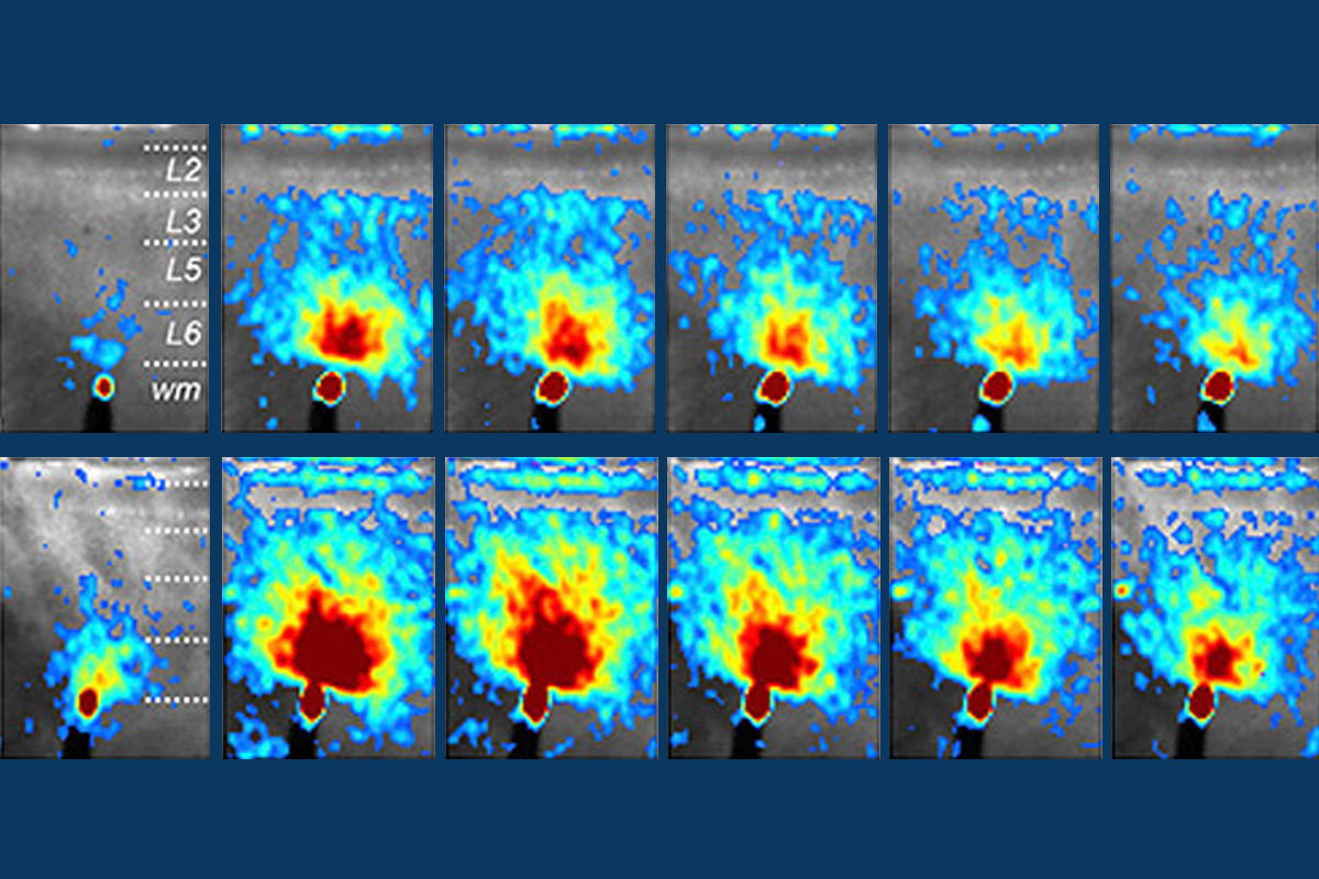 Research image of activity in brain slices from mice lacking one copy of the SYNGAP1 gene.