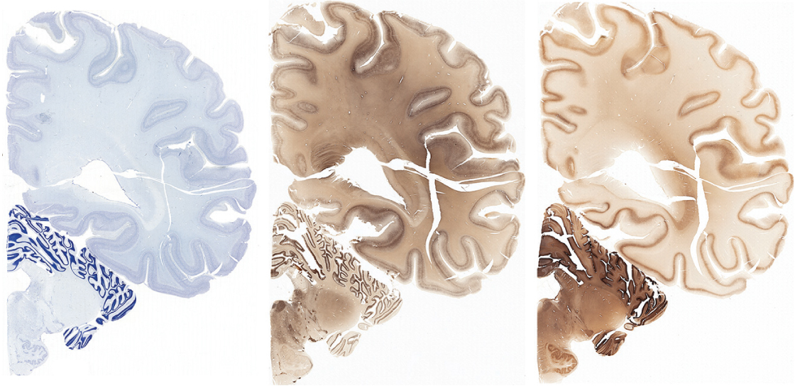 Stained slices of a human brain