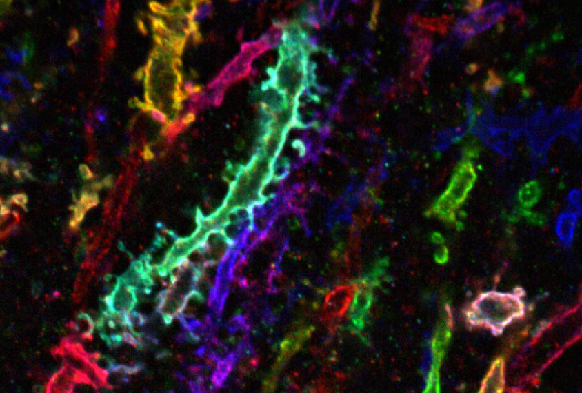 Colorful connections: A new technique yields high resolution images of the signal-receiving branches of neurons.