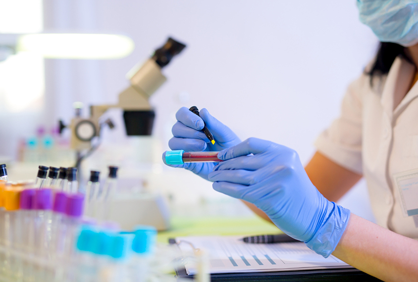 Medical practitioner marking blood sample.