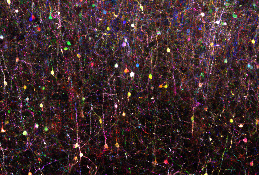 By painting individual neurons distinct colors, researchers can follow the cells more easily.