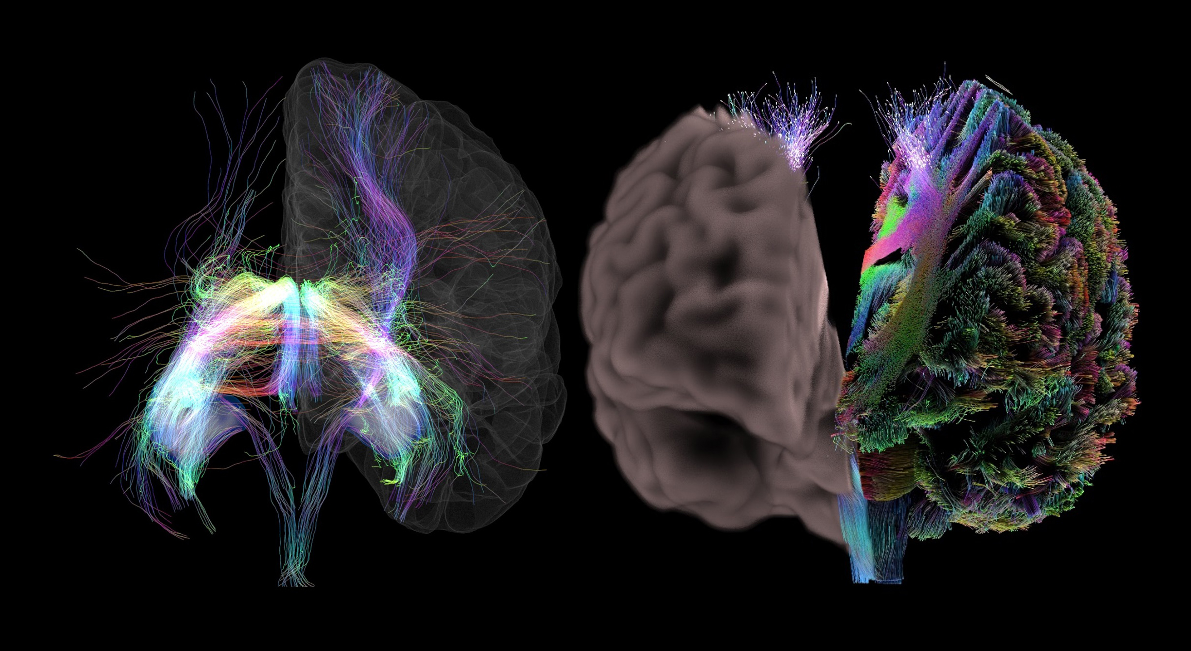 human brain illustration