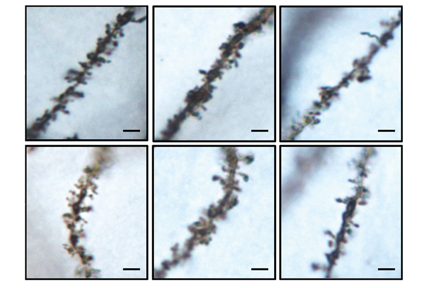 Mice lacking KCTD13 have shorter and fewer neuronal branches (middle and right) compared with controls (left).