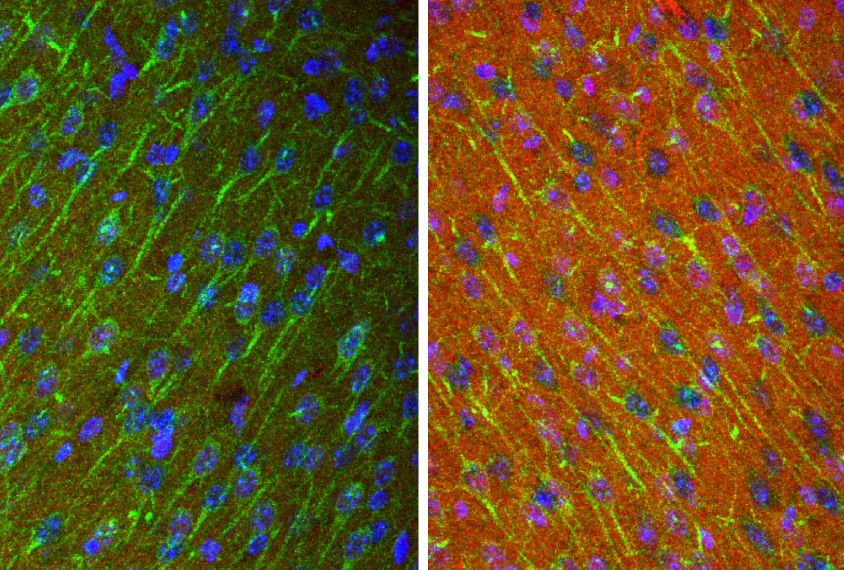 A cancer drug boosts levels of a key protein (red) in mice lacking SHANK3.