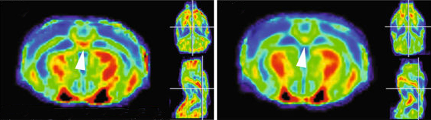 A bundle of nerves connecting the brain’s hemispheres is thinner in mice missing TAOK2 (right) than in controls (left).