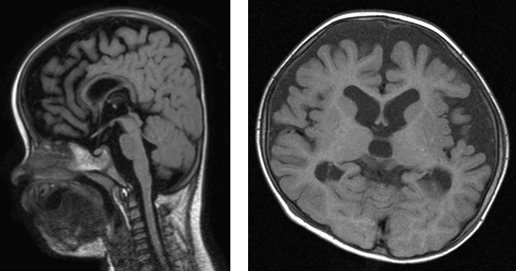 Scan of the frontal lobe of the brain