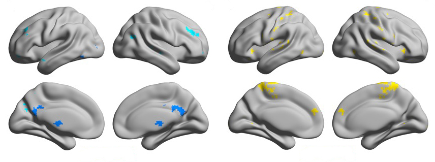eight brains with different regions highlighted