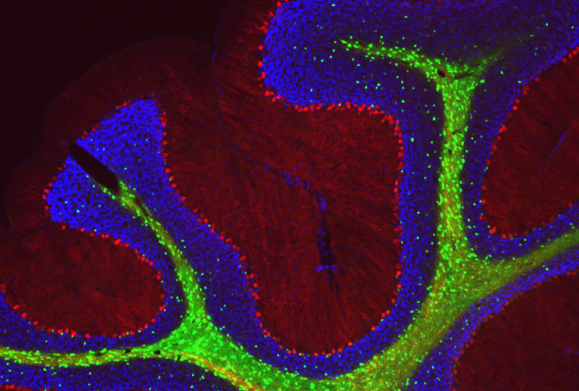 Purkinje neurons glow red in this section.