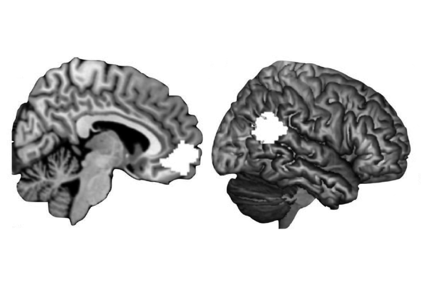 Two brain images highlight social areas.
