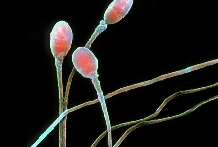 microsopy of human sperm
