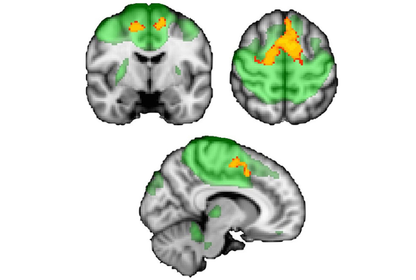 Three views of the human brain show connectivity