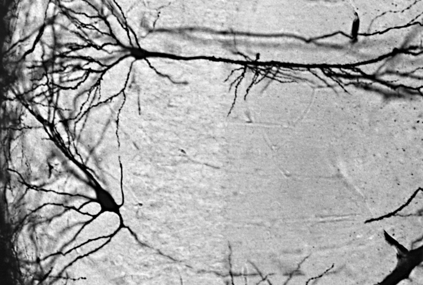 Transplanted neurons rescue social behavior but not brain circuits ...