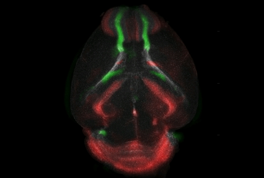 A new technique helps reveal patterns in the migration of neurons (green) to their destination (red).