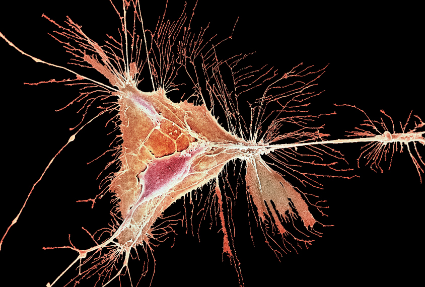 Oligodendrocyte shown orange on black in this scanning electron micrograph.