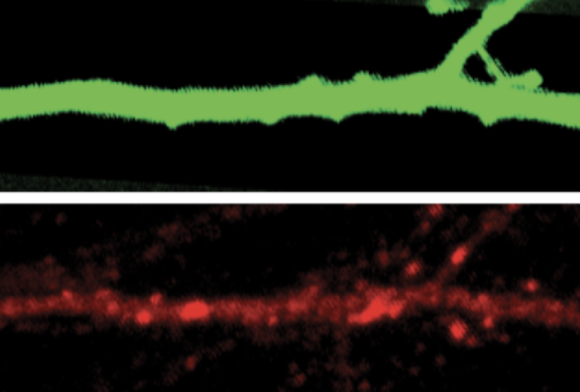 Two neuron images compared side by side