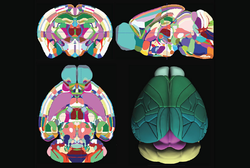 four views of mouse brain