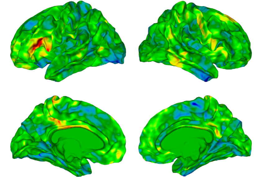 group of 4 brain views