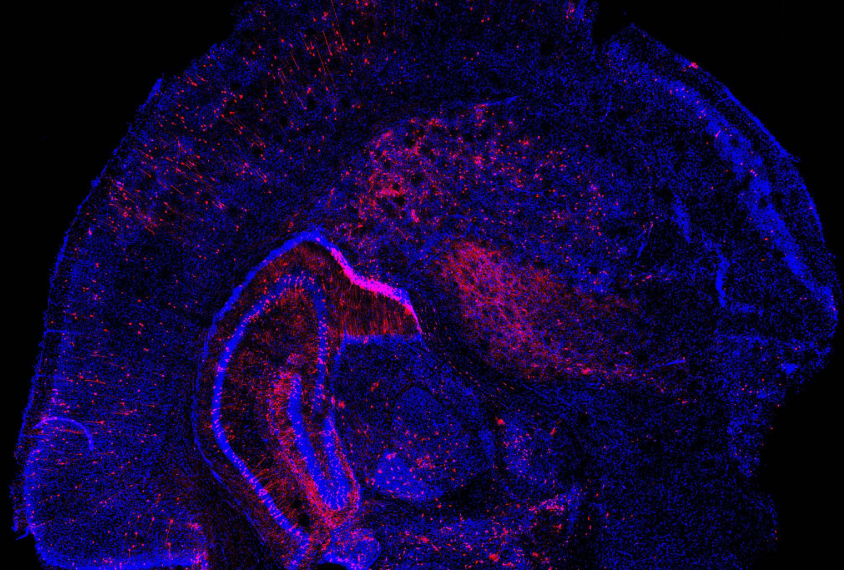 Mutated cells in mouse embryos--the mutations are seen in pink