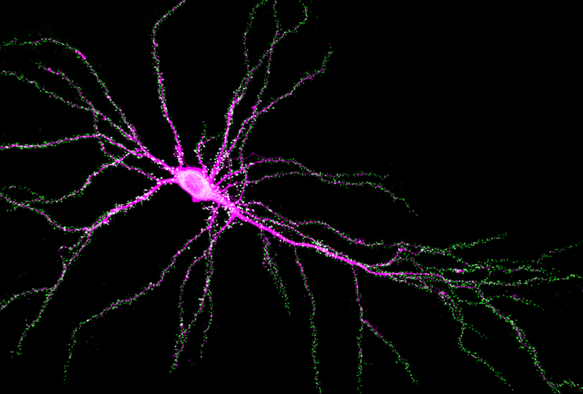 SYNGAP1 protein between neurons.