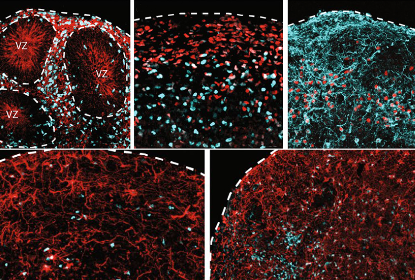 Microscopic views of cortical organiods stained red and green.