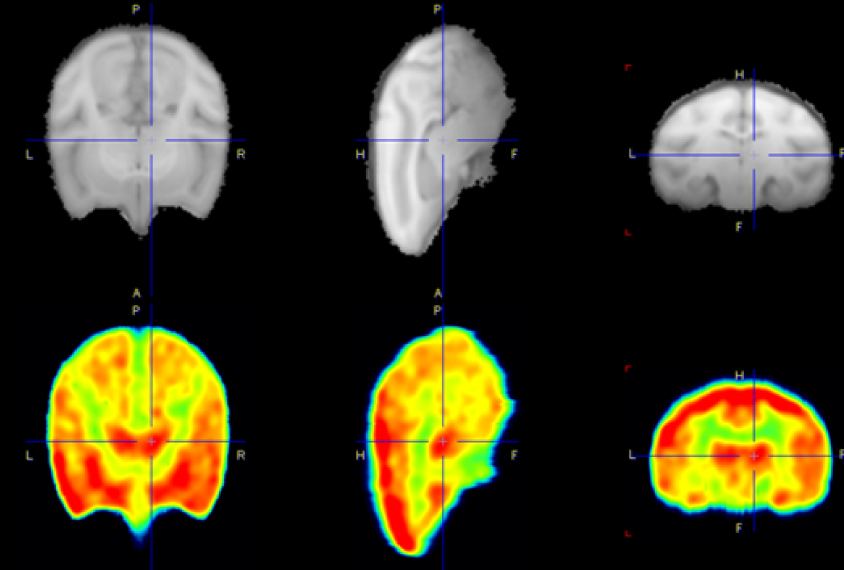 three black and white monkey brain views next to three color versions showing the a drug target area colored red.