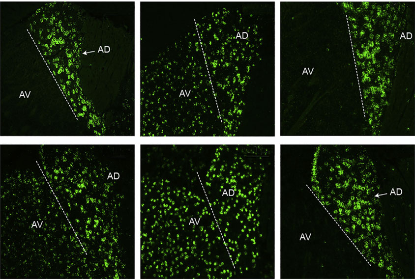 Micrograph showing highlighted genes related to autism in the thalamus.