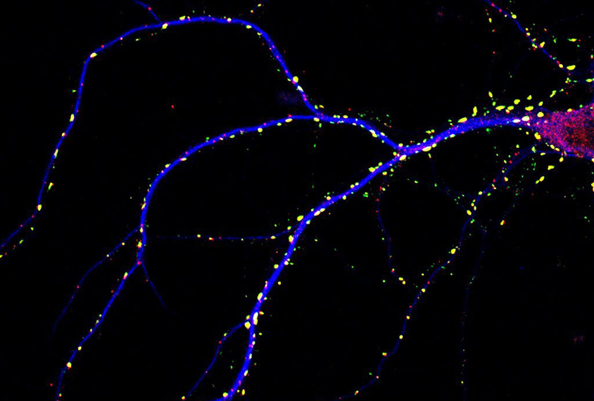 Micrograph of neurons with excess neurons due to excess MECP2 expression.