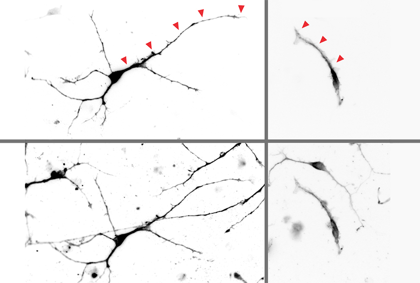 Neurons with low levels of ASH1L have fewer and shorter projections