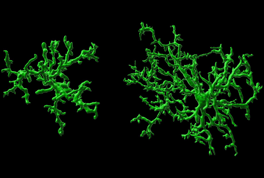 3D reconstruction of mice microglia in green against a black background.