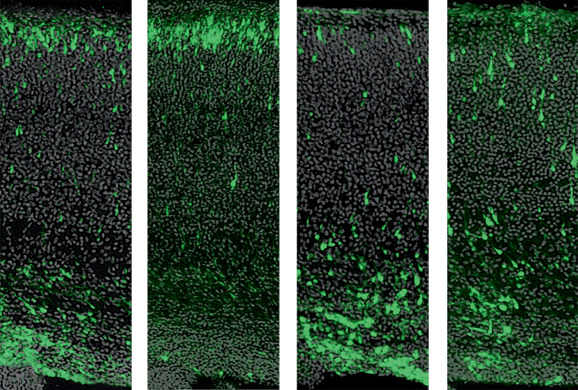 A fluorescent protein reveals altered microtubule dynamics in mice lacking TAOK2 alpha.