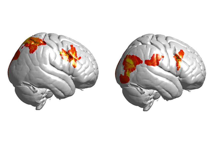 Scans analyzing brain activity during eye contact.