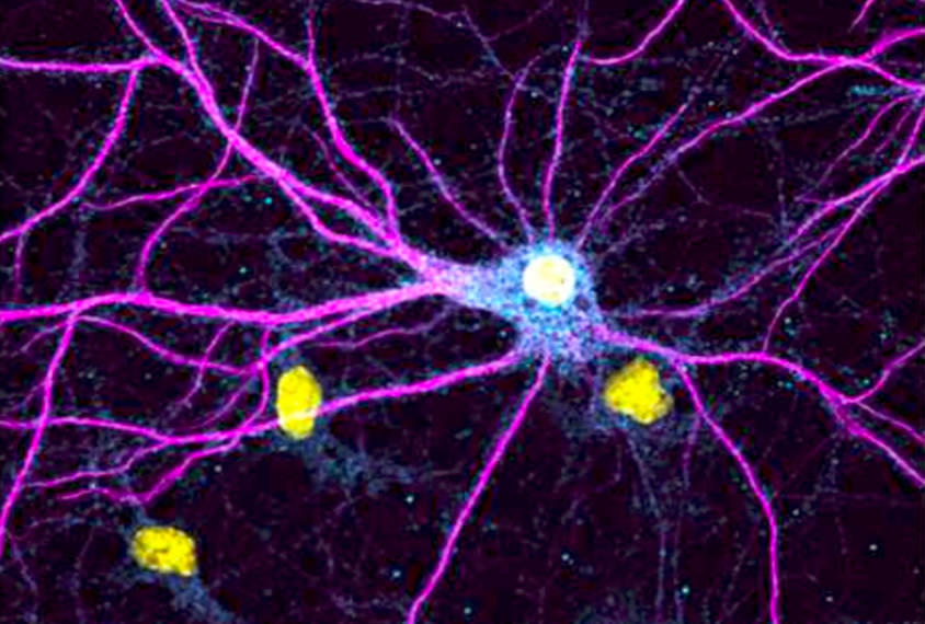 Primary hippocampal neuron.