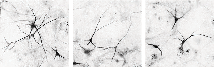 Research image comparing neurons derived from people carrying a 15q13.3 microdeletion to control neurons.