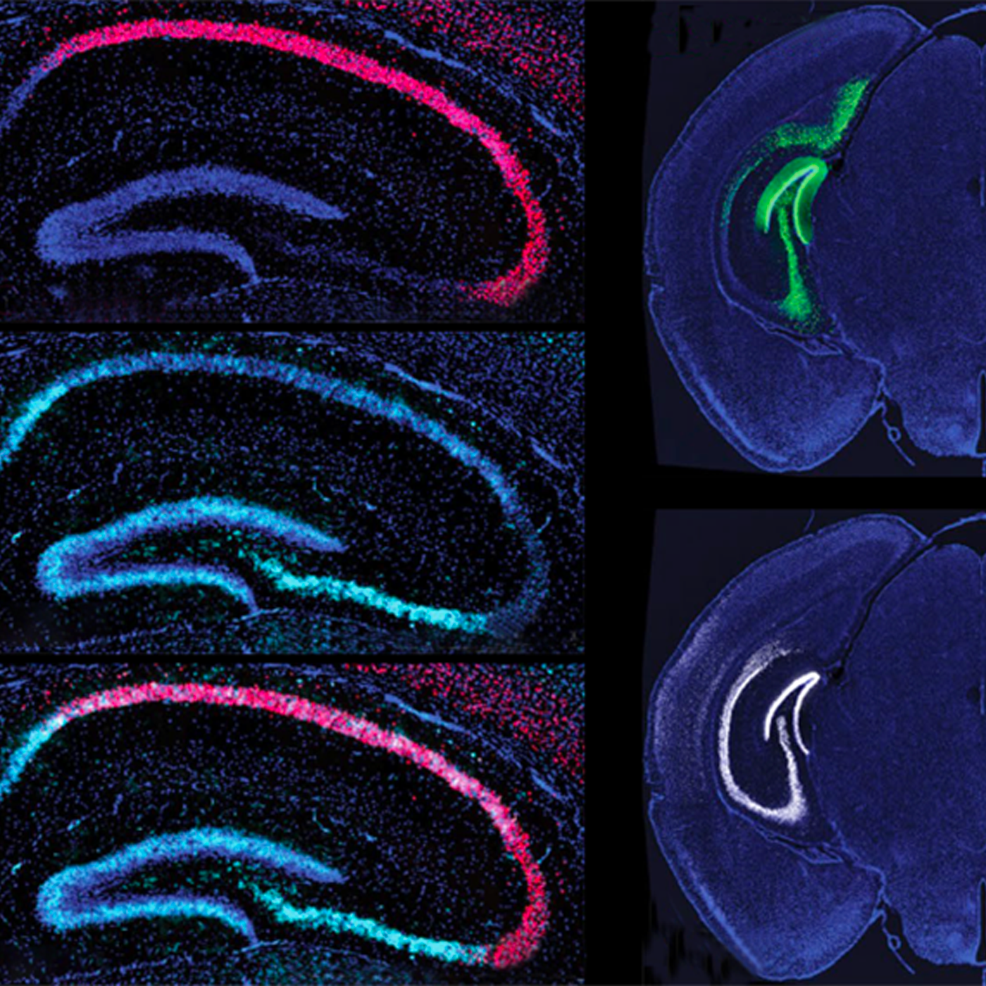 To repair DNA, neurons harness autism-linked proteins