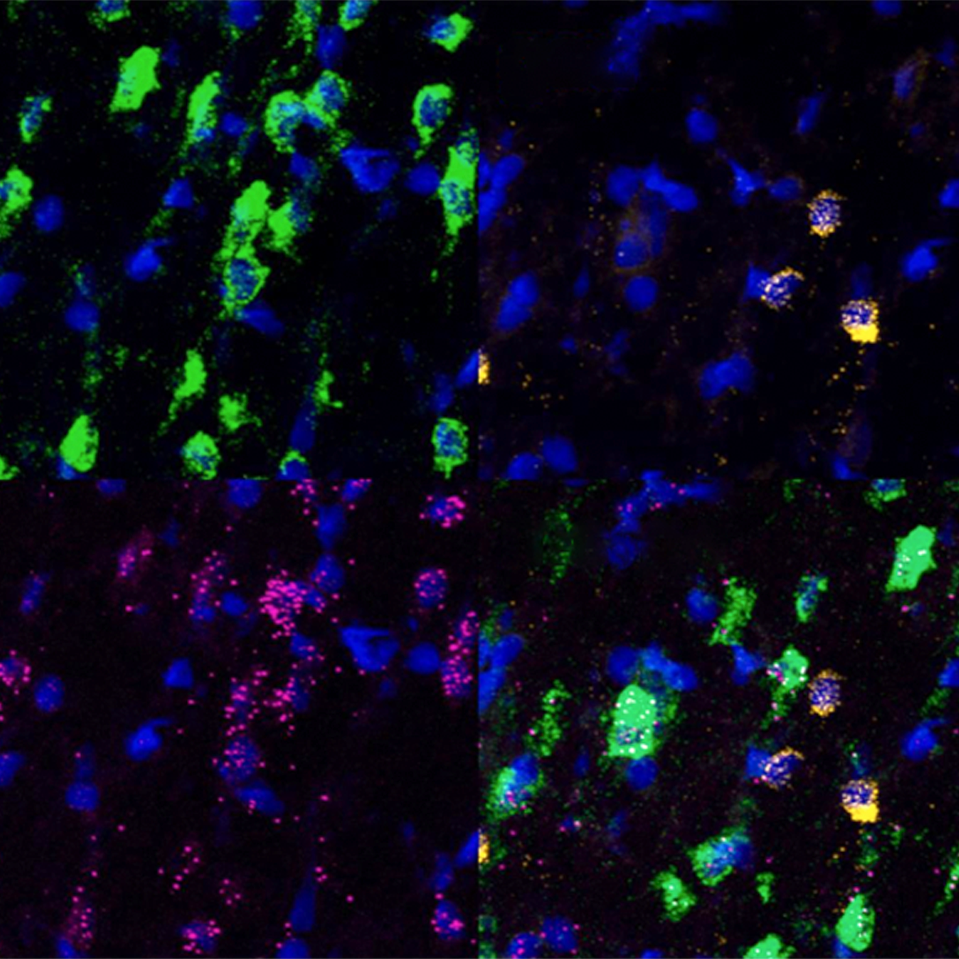 Maternal immune response dulls male rats' social radar