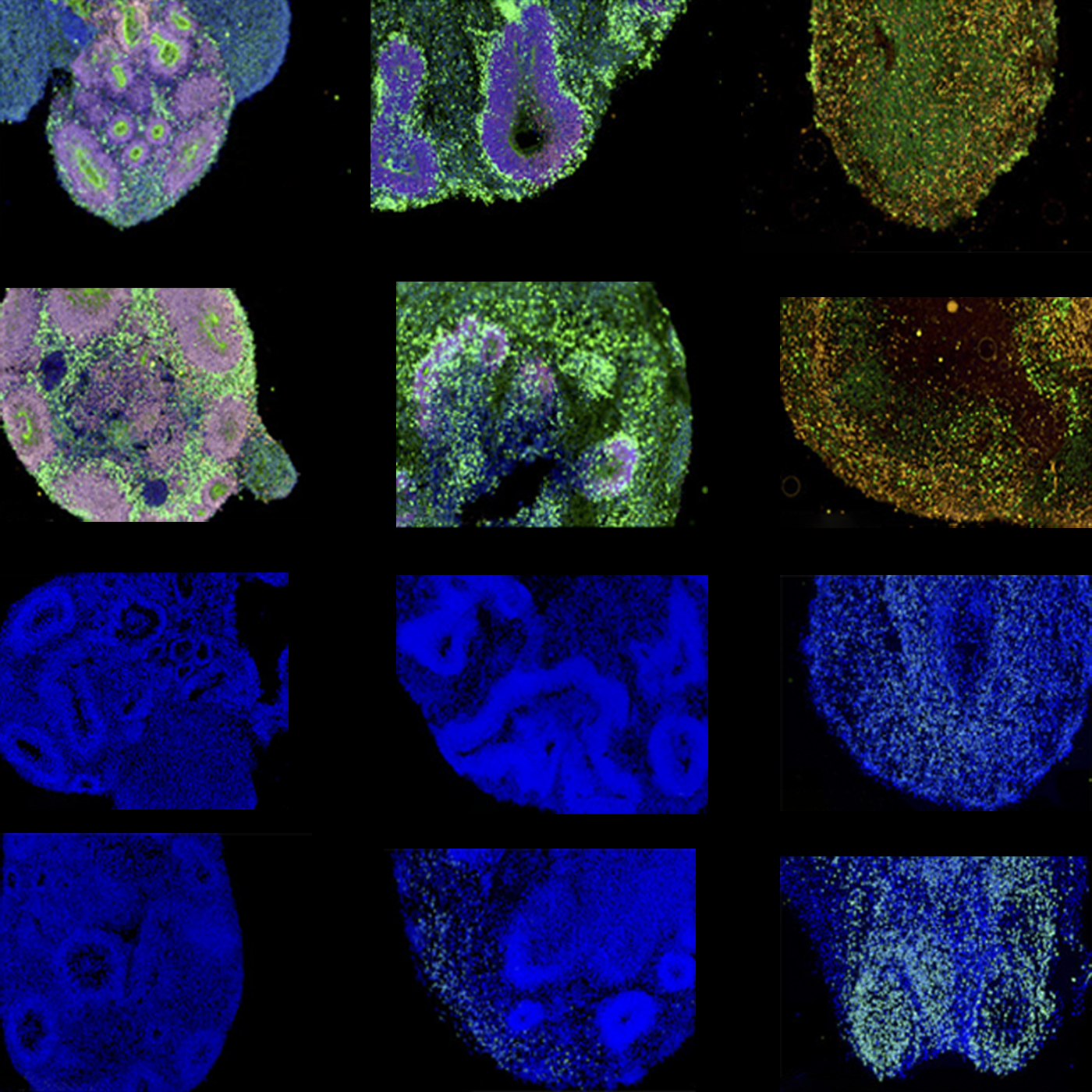 Genetic background sways effects of autism-linked mutation