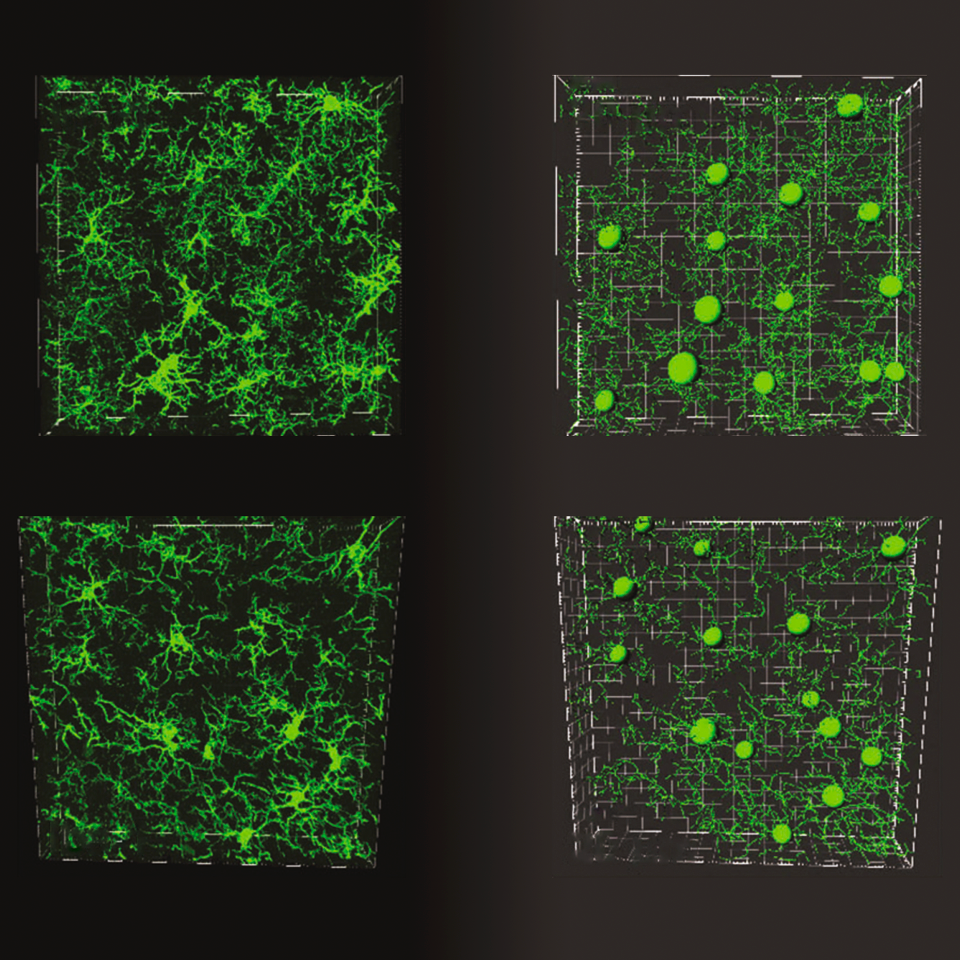 Serotonin powers pruning of developing brain circuits in mice