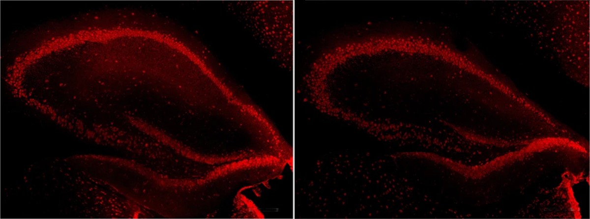 Research images of a mouse hippocampus.