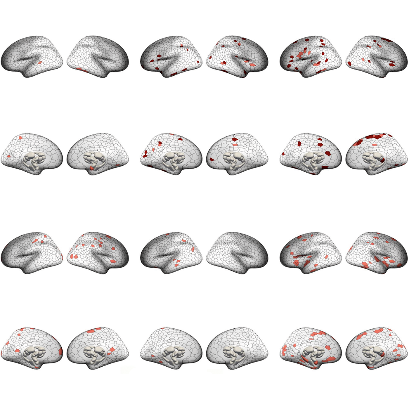 Alterations in circuits characterize six neuropsychiatric conditions