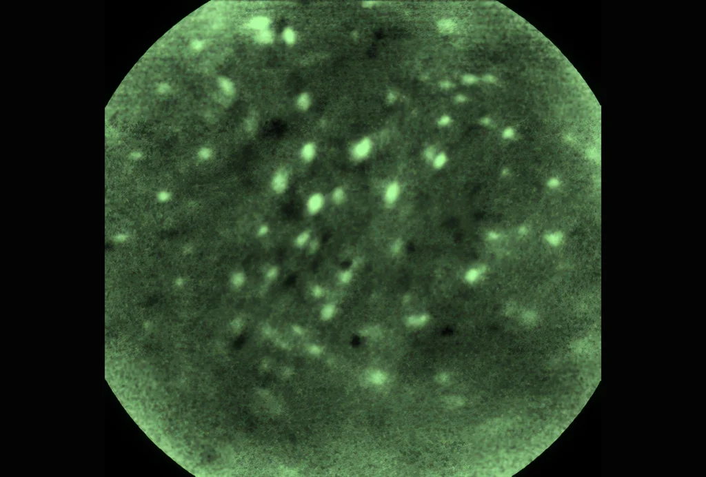 Image of neural activity in a mouse as seen through the Miniscope.